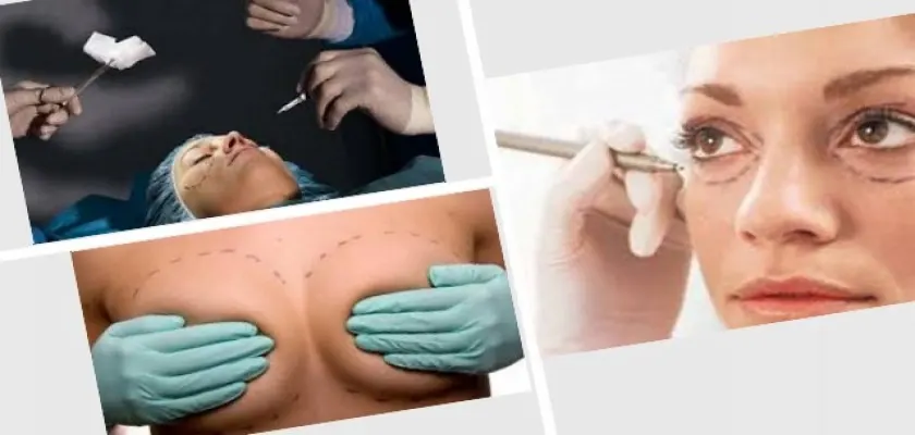 Vücut Estetiği Ameliyatları Hangi Organlara Uygulanır