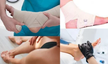 Halluks Rigidus İleri Evrelerinde Cerrahi Seçenekler